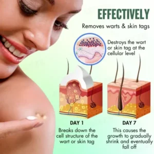 AEXZR® WartsOff Instant Blemish Removal Cream