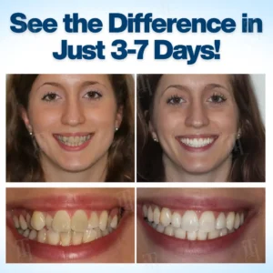 AEXZR® WhitenEase Pro Whitening Pen✨ 𝐖𝐡𝐢𝐭𝐞𝐧 𝐘𝐨𝐮𝐫 𝐓𝐞𝐞𝐭𝐡 𝐢𝐧 𝟕 𝐃𝐚𝐲𝐬! 🦷