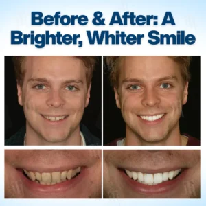 AEXZR® WhitenEase Pro Whitening Pen✨ 𝐖𝐡𝐢𝐭𝐞𝐧 𝐘𝐨𝐮𝐫 𝐓𝐞𝐞𝐭𝐡 𝐢𝐧 𝟕 𝐃𝐚𝐲𝐬! 🦷