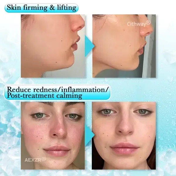 Aexzr® Anti-swelling Gel Beads Facial Therapy Mask