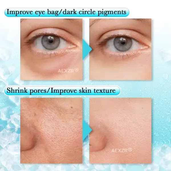 Aexzr® Anti-swelling Gel Beads Facial Therapy Mask