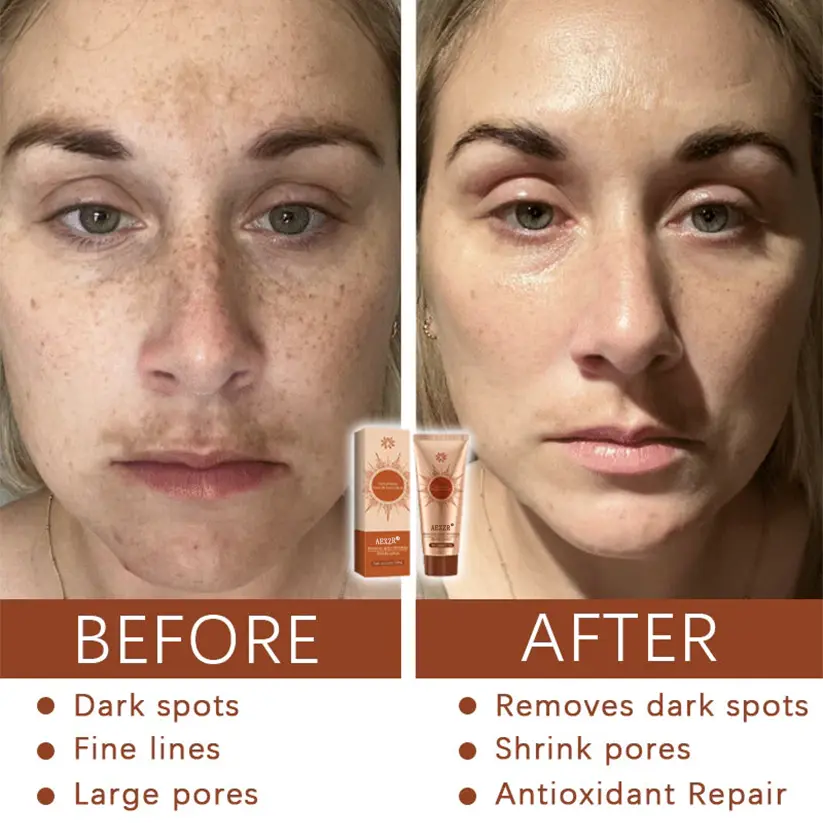 ✨LOWEST PRICE UP TO 50% OFF ✨| AEXZR® Herbal Spots Peel-Off Facial Mask