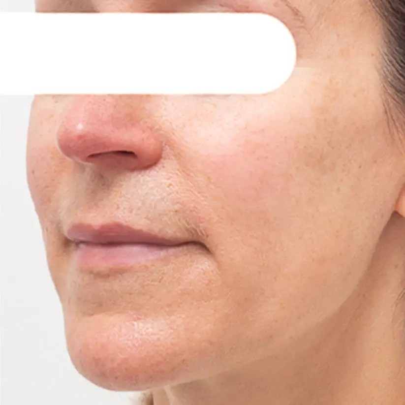 ✨LOWEST PRICE UP TO 50% OFF ✨| AEXZR® Herbal Spots Peel-Off Facial Mask