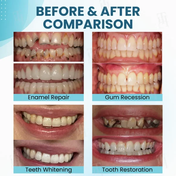 🔥The FDA-Approved Solution🌟 Official Store | AEXZR® Makesmile Bee Venom Oral Treatment Powder