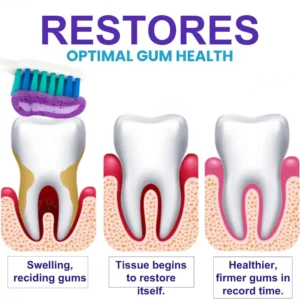 🏷️ EXCLUSIVE DEAL! 34% OFF - AEXZR® Apisphere Dental Repair Toothpaste