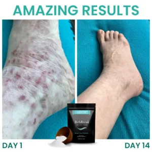 🏷️ EXCLUSIVE DEAL! 50% OFF - AEXZR® ItchBreak Sea Salt Soak