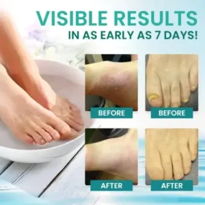 AEXZR® ItchBreak Sea Salt Soak