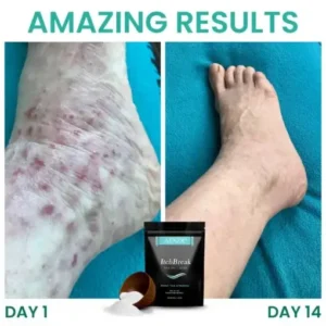 AEXZR® ItchBreak Sea Salt Soak