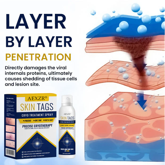 AEXZR® Skin Tag Cryo Treatment Spray - Image 4