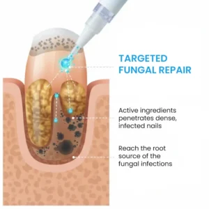 🏷️ EXCLUSIVE DEAL! 50% OFF - AEXZR® NanoFix Nail Repair Pen