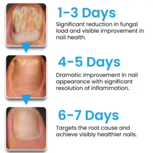 🏷️ EXCLUSIVE DEAL! 50% OFF - AEXZR® NanoFix Nail Repair Pen