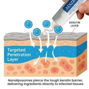 AEXZR® HPV Genital Wart Treatment Cream