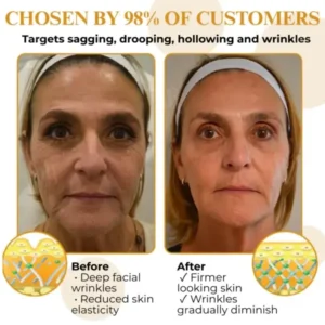 AEXZR® Letybo Bee Venom Wrinkle Removal Cream