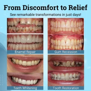 🎉 New Year's Special！👨‍⚕️ Dentist's Choice: AEXZR® Non-Surgical Gum "Suture" Gel